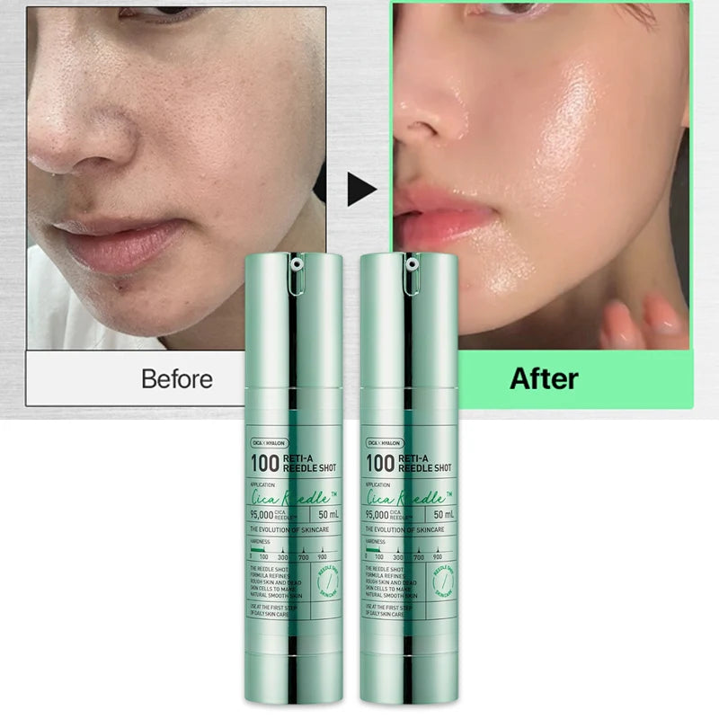 Retinol Vitamin A Serum Repairing Skin Ideal for Retinol Beginner Glass Skin Korean Skin Booster 1.69Fl Oz For Intense Hydration