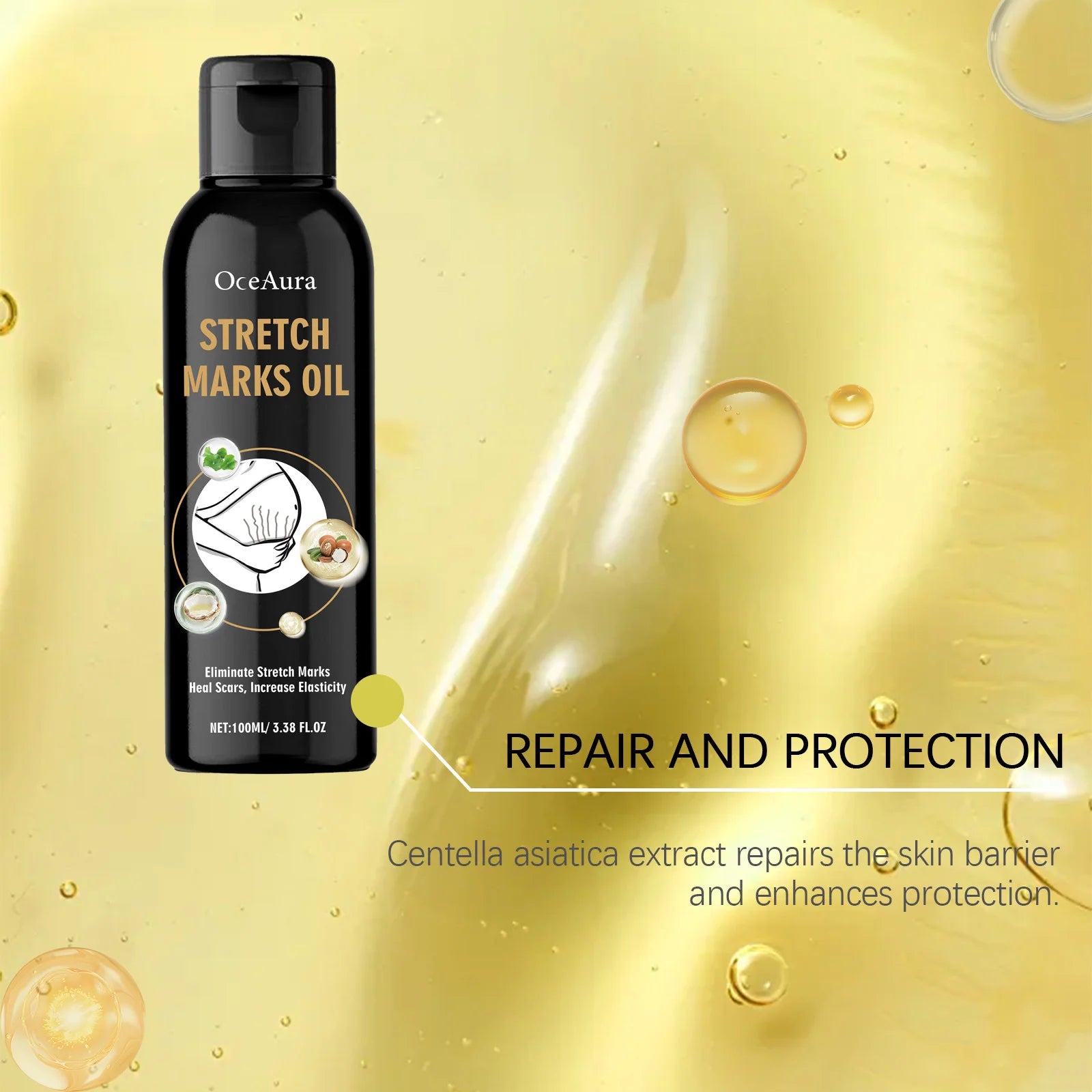 Stretch Marks Removal Oil Removes Postpartum Pregnant Women Scar Improve Sagging Smoothing Skin Whiten Repair Firming Skin Care