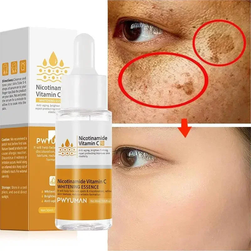 Vitamin C Brightening Freckles Cream Nicotinamide Improve Dark Spot Melanin Moisturizing Nourishing Facial Serum Skin Care