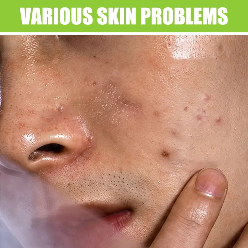 WaterIceLevin Green Tea Salicylic Acid Mens Facial Wash Deep Cleansing Oil Control Tea Tree Charcoal Refreshing Gentle Cleanser