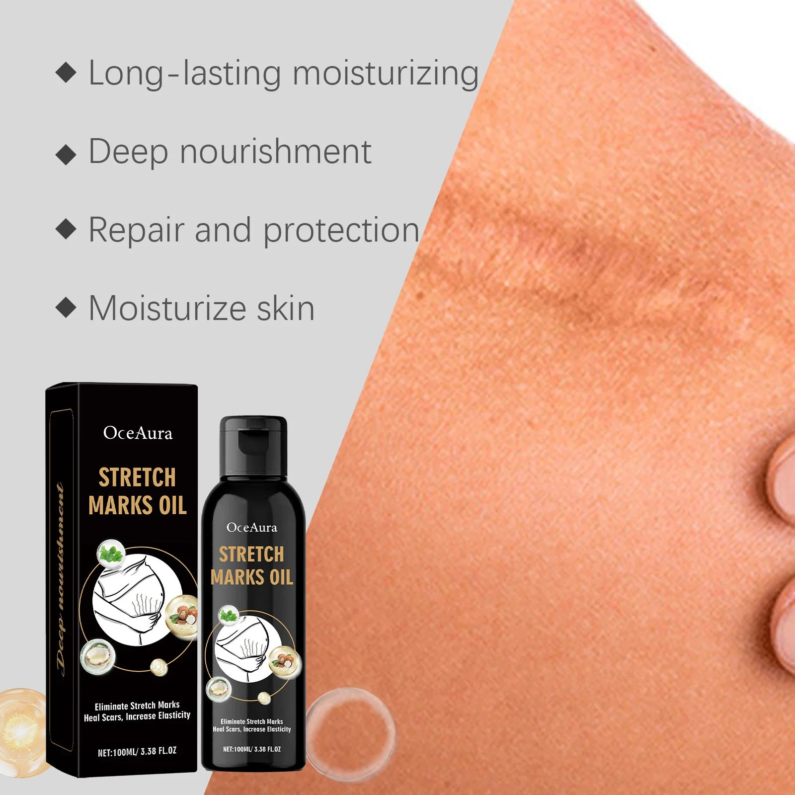 Stretch Marks Removal Oil Removes Postpartum Pregnant Women Scar Improve Sagging Smoothing Skin Whiten Repair Firming Skin Care