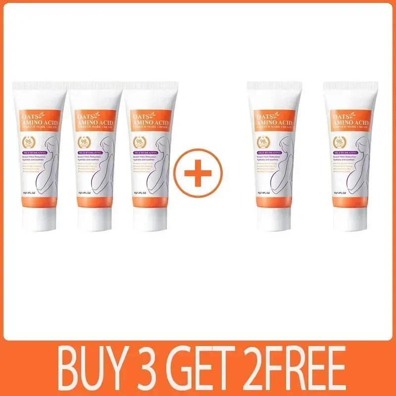 Cream For Pregnancy Stretch Marks Removal Eliminate Red White Old Stretch Marks  2025