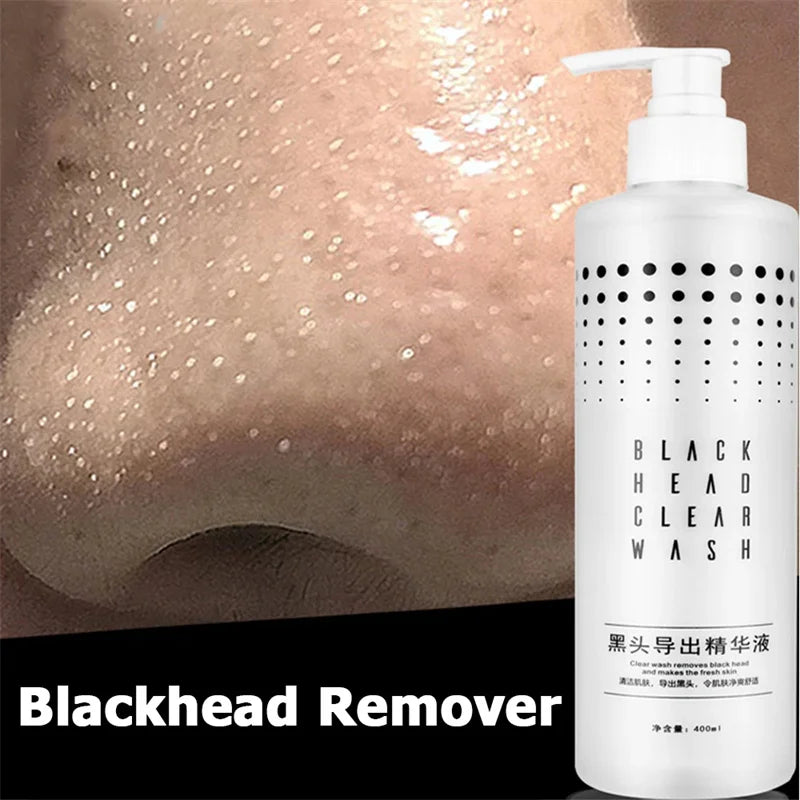 Blackhead Remover Liquid 400ml Deep Cleansing Pore Minimizer with Fruit Acid, Oil Control Toner for T-Zone & Blackhead Treatment