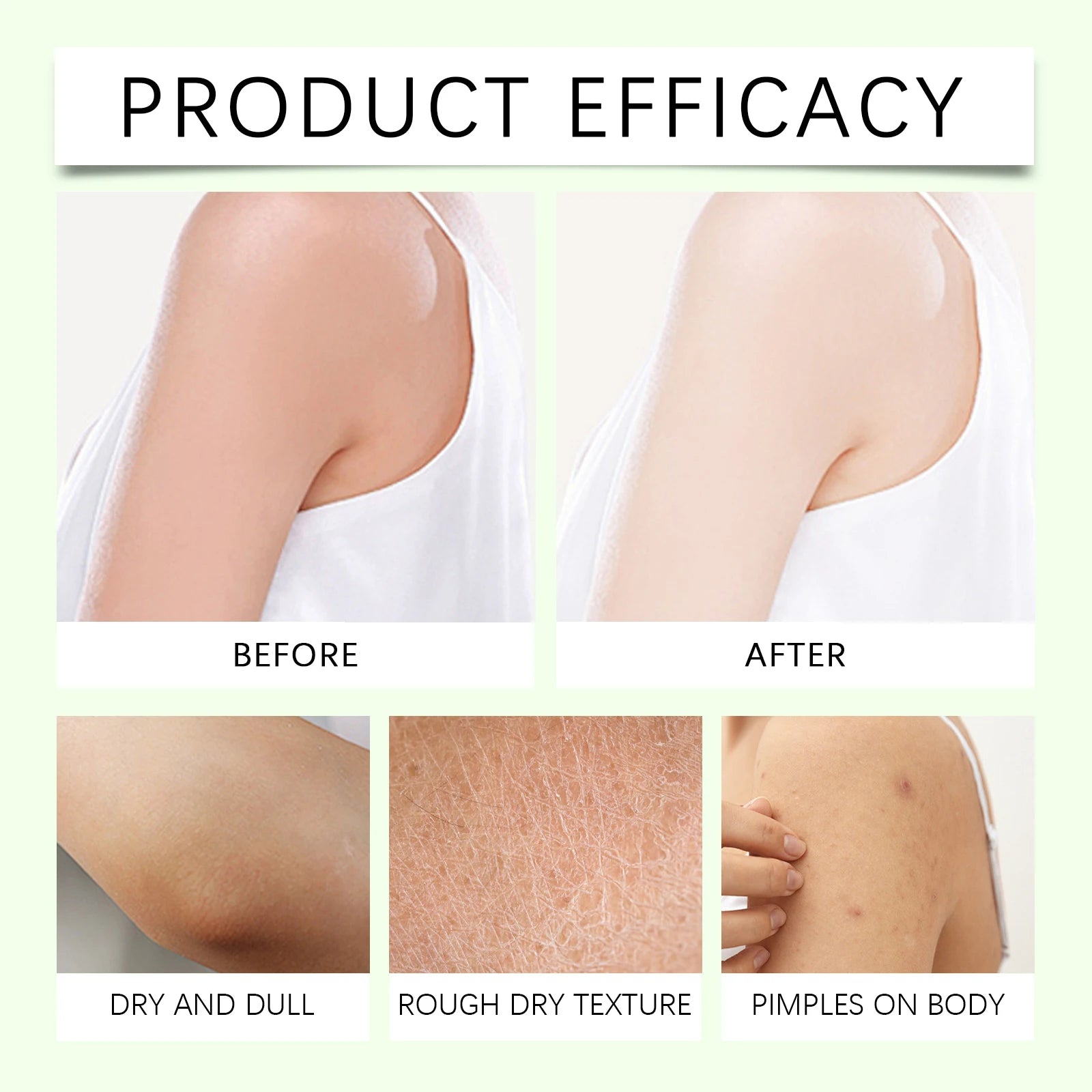 Shea Butter Body Lotion Soothing Intense Hydrating & Barrier Repair Cream for Silky Smooth Skin Moisturizing Skin Crack Remover