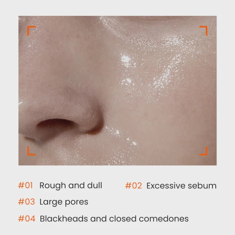 240ml Glycolic Acid 7% Hydrating Toning Solution AHA Exfoliating, Pore Minimizing & Brightening Face Toner for All Skin Types