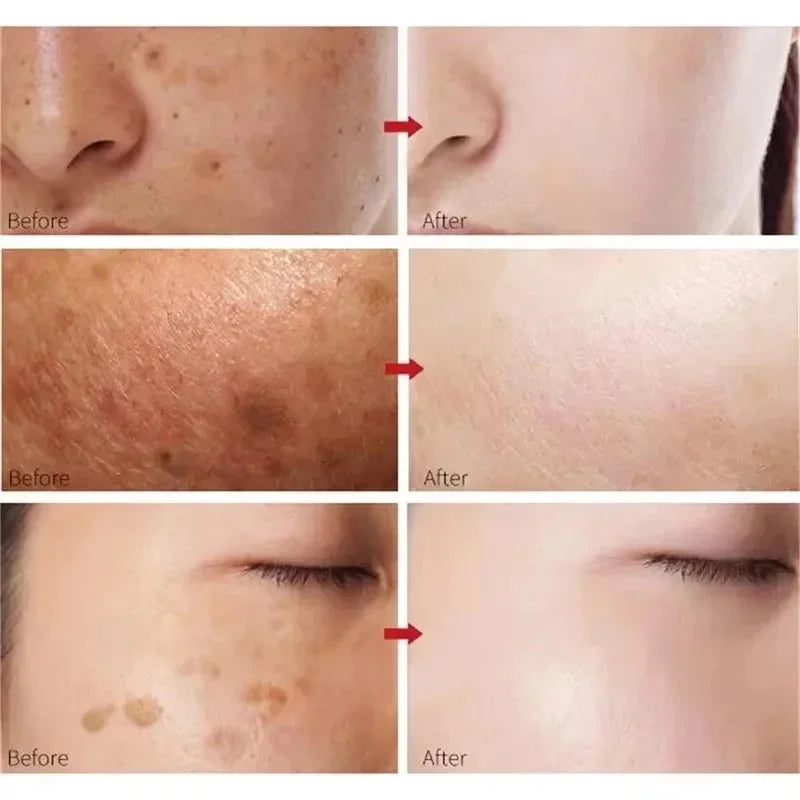 Moisturising Anti-Drying Facial Oil Increase Elasticity Smooth Softening Skin Care Peach 70% Niacinamide Serum 30ml