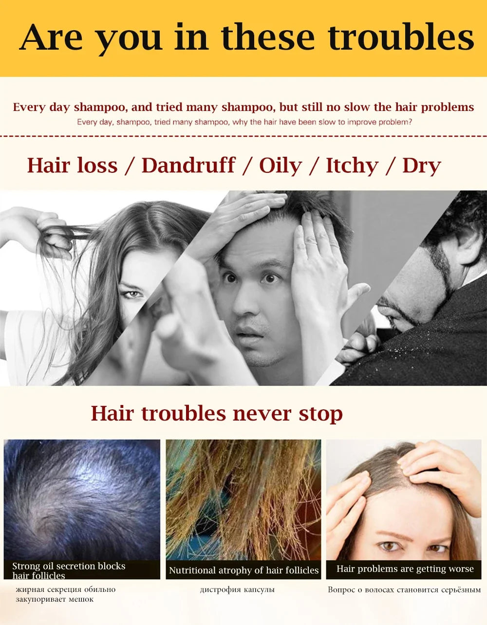 1 Bottle Ginger Juice Anti Hair Loss Hair Shampoo Professional Repair Damage Hair, Hair Growth DENSE,ANTI ITCHING,OIL CONTROL