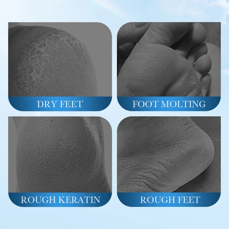 SADOER Coconut Foot Mask Moisturizing Whitening Foot Peeling Mask Anti-aging Exfoliating Feet Pedicure Exfoliant Feet Skin Care