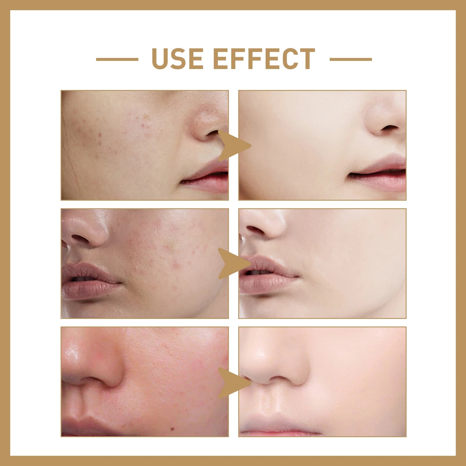 Rice Toner Moisturizes, Brightens, Shrinks Pores, Prevents Dryness, Suitable For All Skin Types And Facial Skincare Products