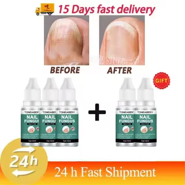 Nail Fungus Treatment Serum Foot Repair Liquid Toe Nails Fungal Removal Gel Anti Infection Paronychia Onychomycosis Cream 10ml