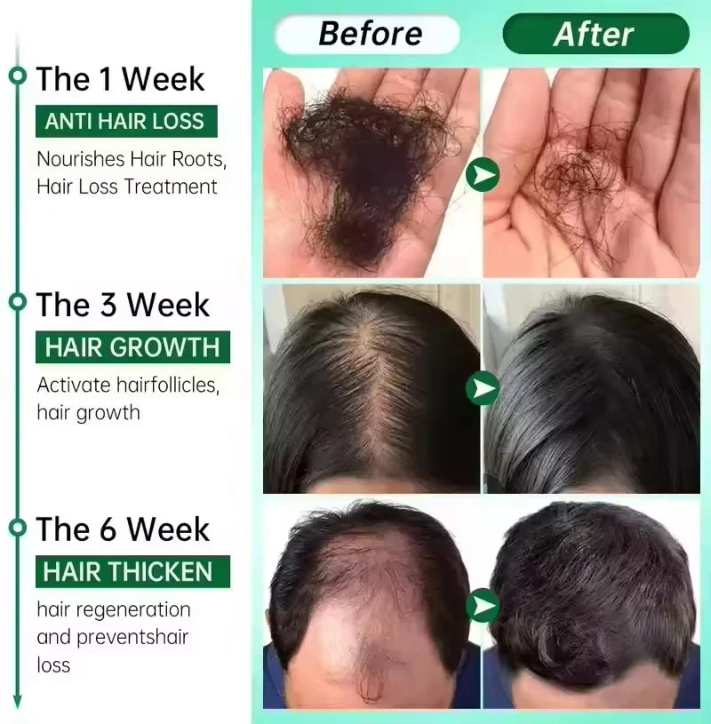 Fast Hair Growth Serum Spray Anti Hair Loss Prevent Baldness Scalp Treatment Repair Roots Beauty Health Hair Care For Men Women