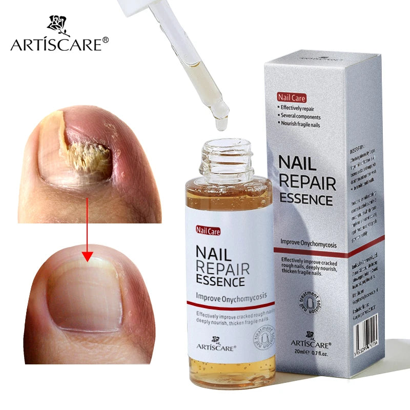 ARTISCARE Nail Care Essence Feet Care Nail Serum 20mL