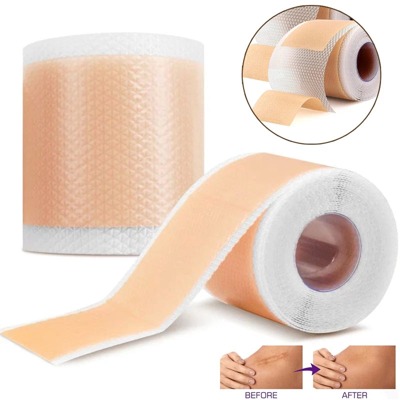 Silicone Scar Sheets - Reusable Scar Tape for Keloid, C-Section, Surgery, Burn, Acne - Waterproof, Hypoallergenic, Latex-Free