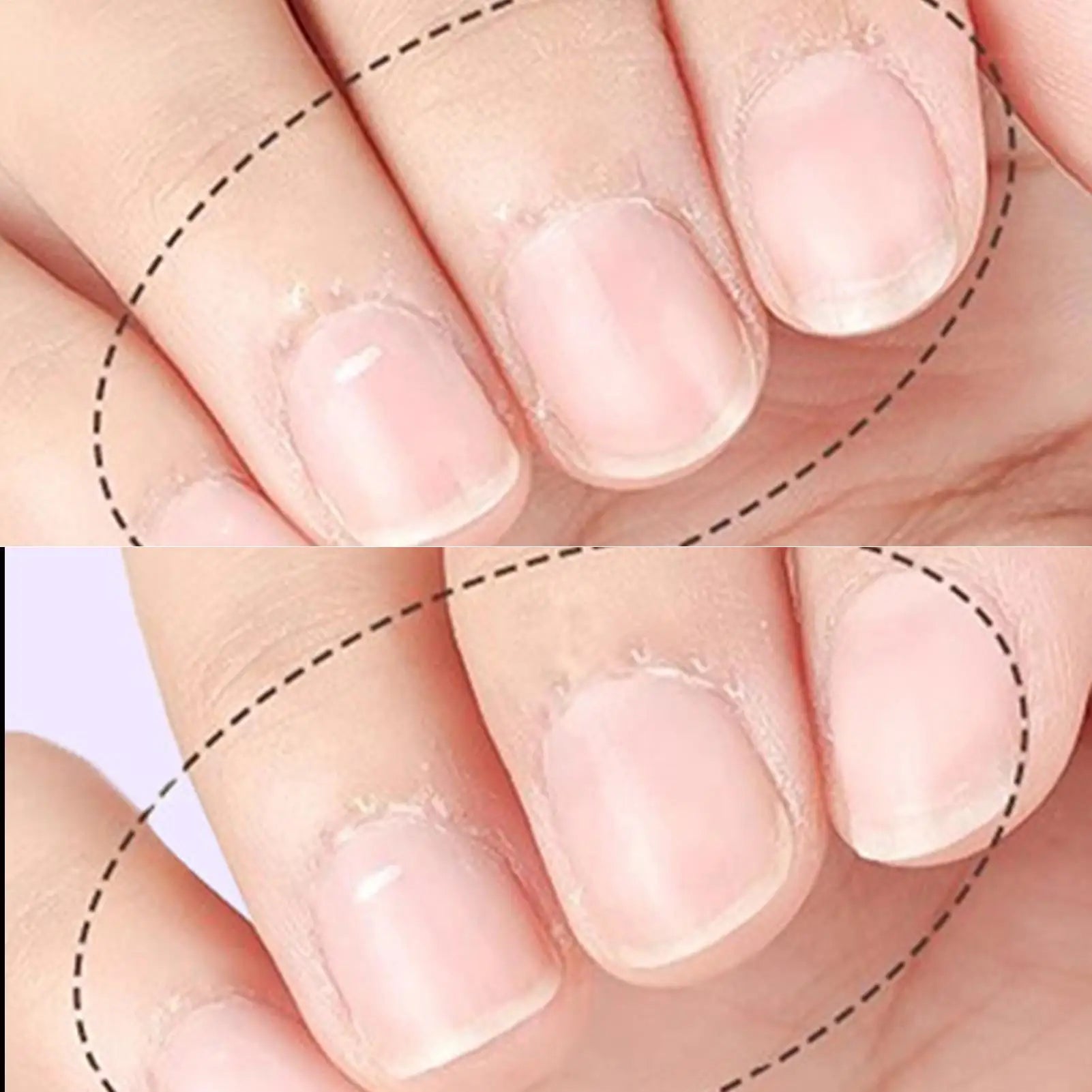3in-1 Cuticle Oil Pen Nail Strengthener Damaged Nail Care Chip-resistant Dead Skin Cuticle Remover Pen For Nourishing Split