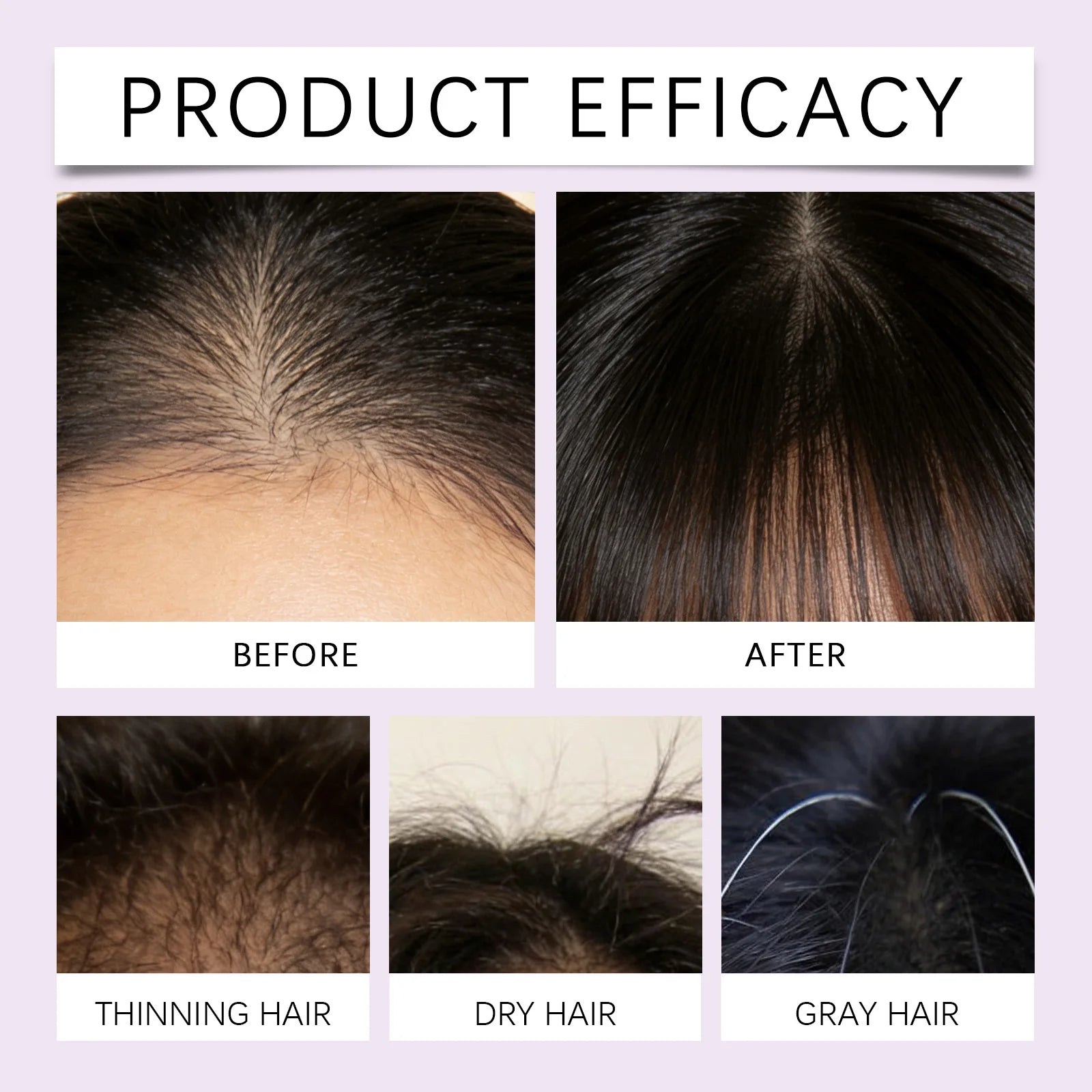 Instant Ficus Hair Essential Oil Biotin Gentle Nourishing Scalp Massage Serum Smoothing Brightening Soften Hair Care Conditioner