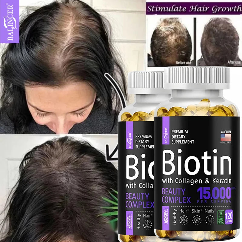 Biotin Capsules 15,000 MCG - Increase Healthier, Shinier Hair, Skin & Nails- 30 To 120 Capsules with Biotin Collagen A & B
