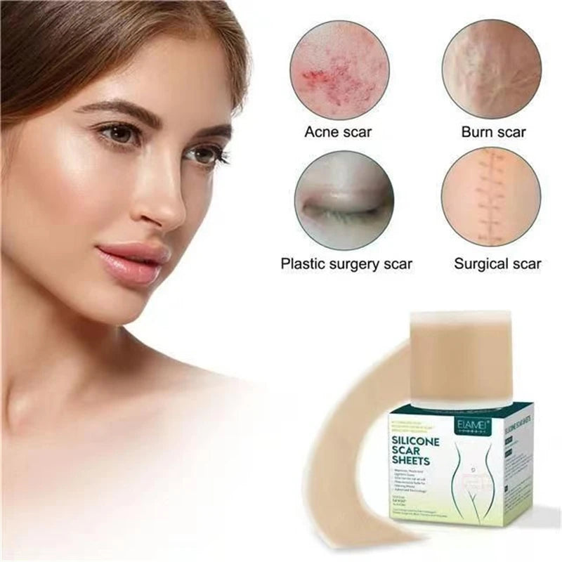 Silicone Scar Sheets - Reusable Scar Tape for Keloid, C-Section, Surgery, Burn, Acne - Waterproof, Hypoallergenic, Latex-Free