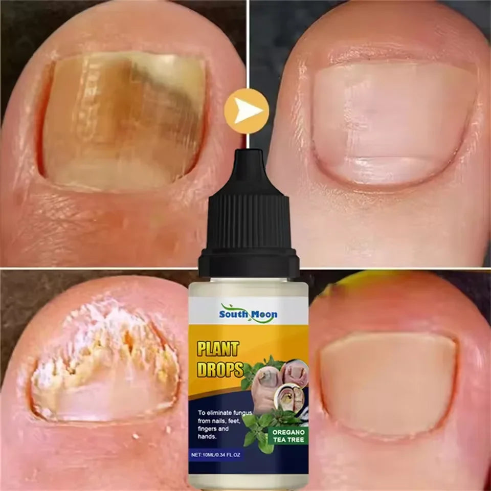 7 DAYS Nail Fungus Treatments Liquid Serum Anti-Infection Onychomycosis Paronychia Hand Care Nails Foot Fungal Removal Gel 10ml