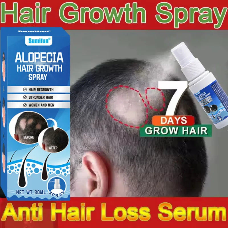 Fast Hair Growth Serum Spray Anti Hair Loss Prevent Baldness Scalp Treatment Repair Roots Beauty Health Hair Care For Men Women