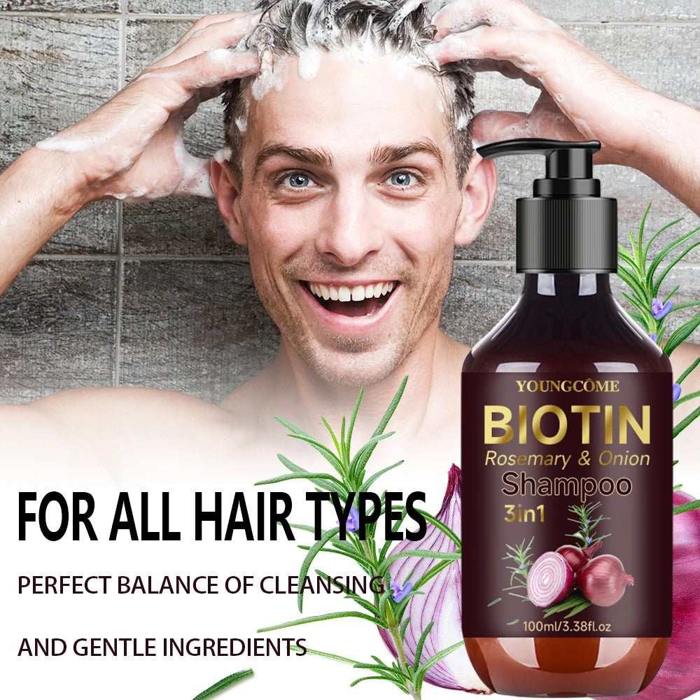 Shampoo Gently Clean Hair Biotin Rosemary Onion Shampoo Remove Dandruff Control Oil Reduce Hair Loss Stabilize Hair Roots Nouris