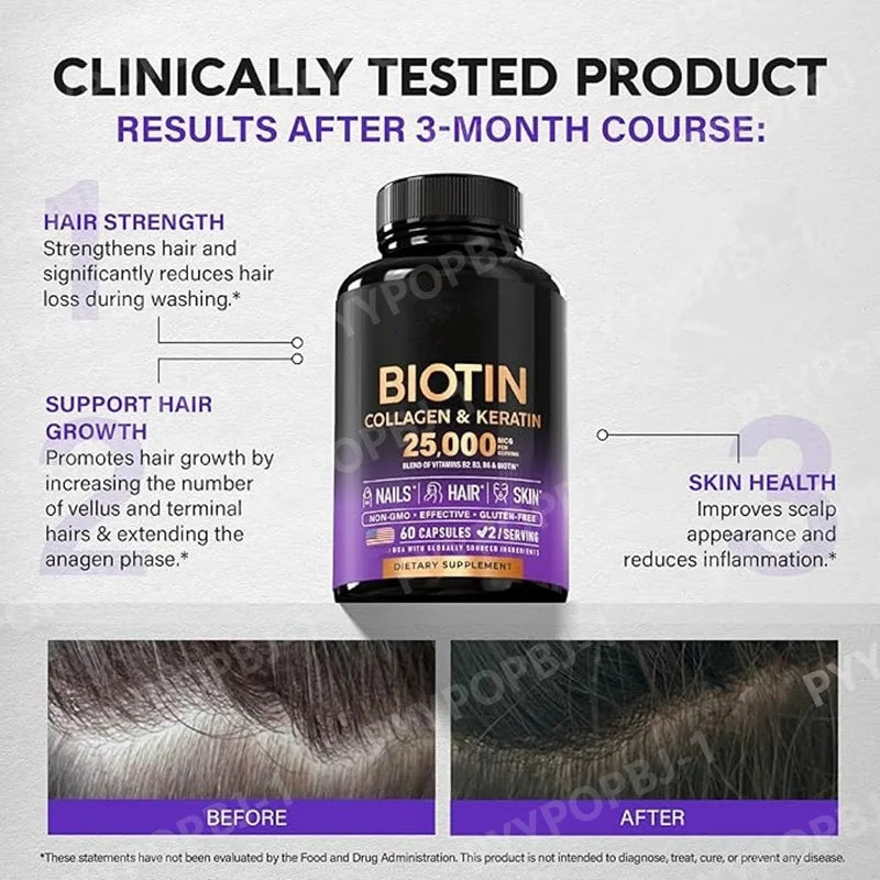 Biotin Capsules Contain Collagen and Vitamin B2, B3, B6 & B7 for Women Men Hair Care Supplements Skin & Nails Support 60 Pieces