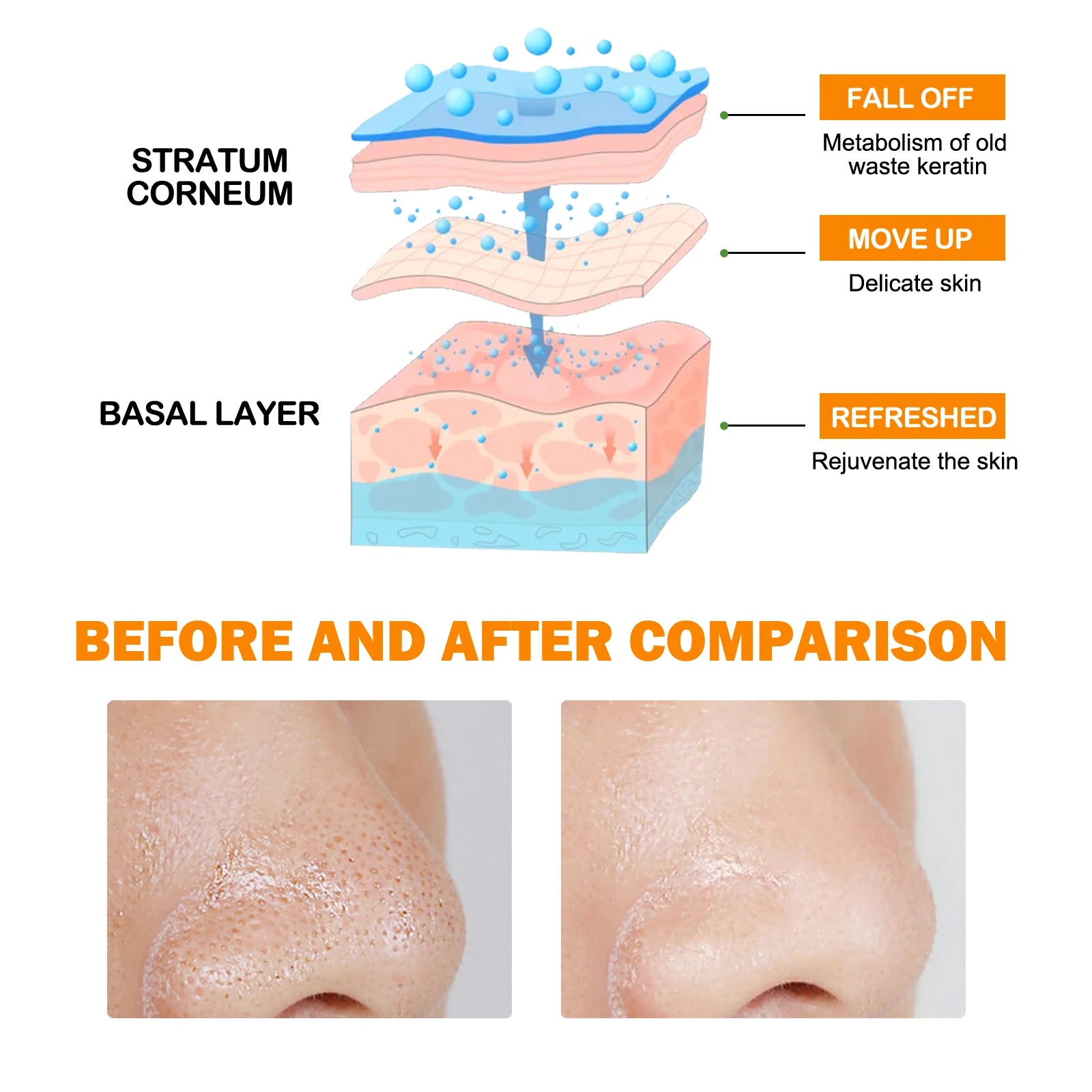 Enzymes Exfoliating Brightening Gel Salicylic Acid Blackhead Dead Skin Remover Cleansing Shrink Pores Brightening Delicate Skin