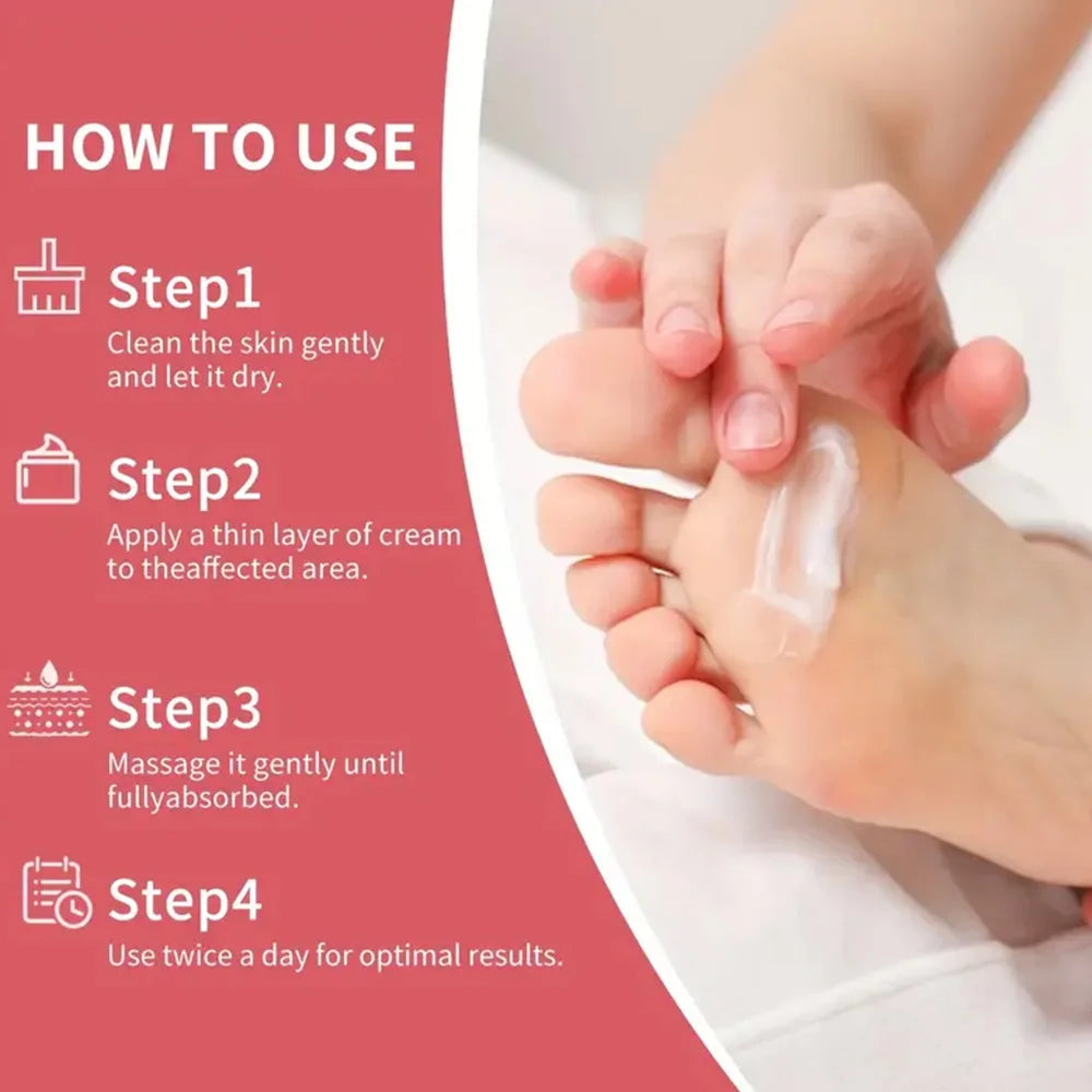 42% Urea Strawberry Hand and Foot Cream,moisturizes Andsmooths Your Hands and Feet Suitable for Men and Women of All Skin Types