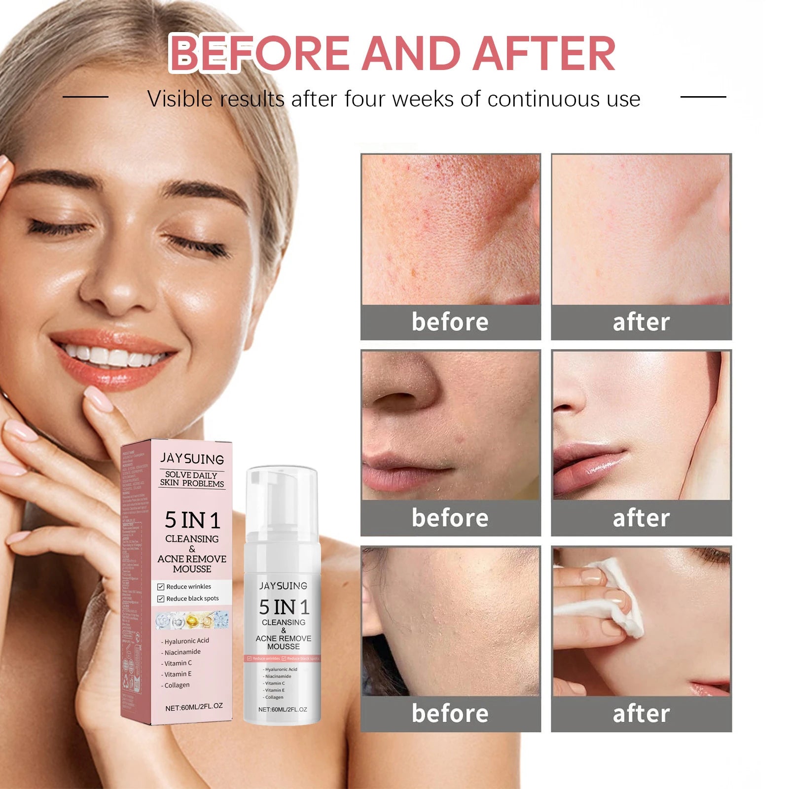 5 in 1 Facial Cleansing Mousse Hyaluronic Acid Hydrating Foam Cleanser Pore Shrink Pores Moisturizing korea Face Skin Care