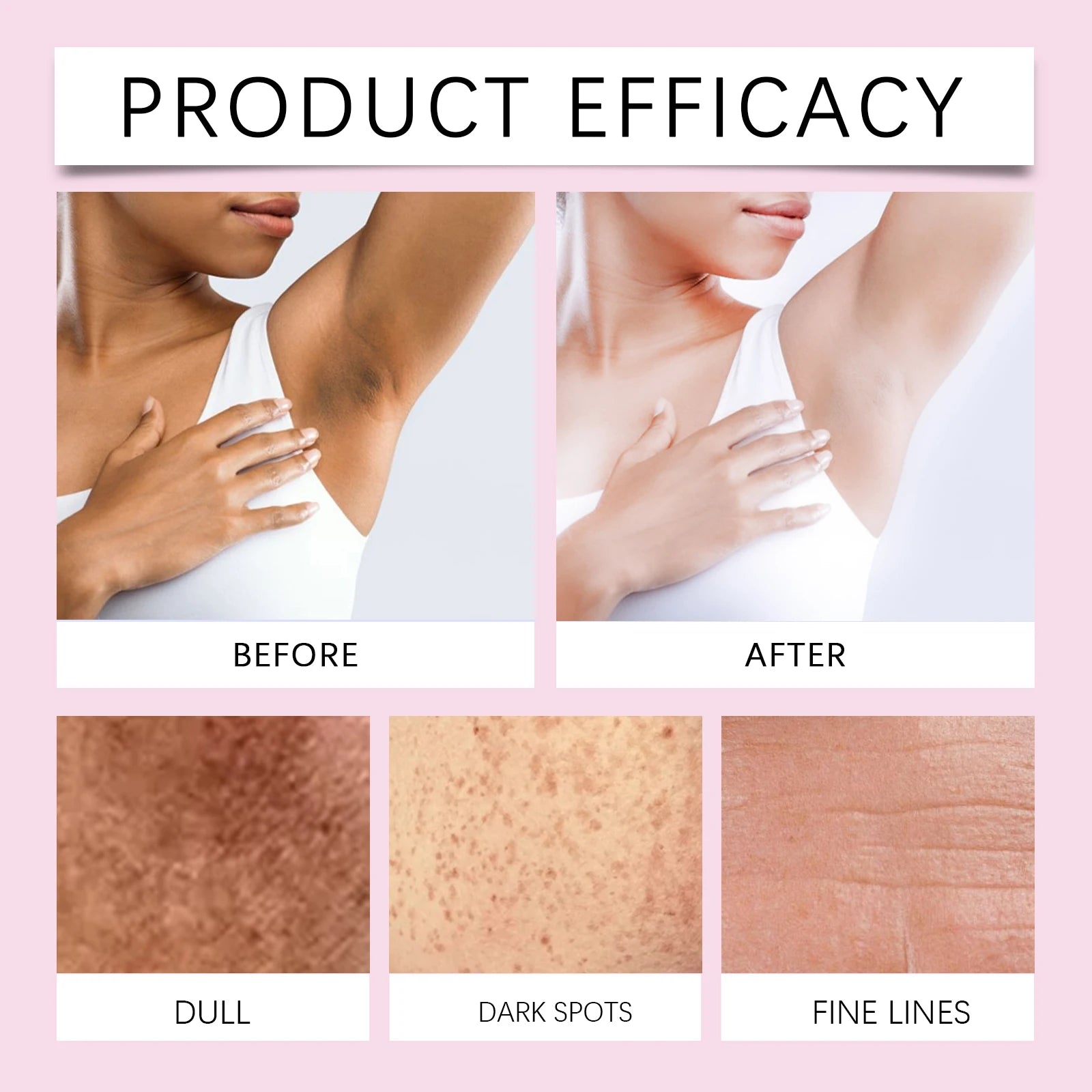 HOYGI Body Whitening Bleach Cream Brightening Underarm Elbow Knees Joint Removal Intimate Parts Dark Spots Melanin Body Lotion