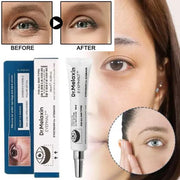 Eyebag Cream 15ml Anti-wrinkle Eye Cream For Dark Circles, Moisturizing Firming Treatment, Lightens Fine Lines Reduces Puffiness