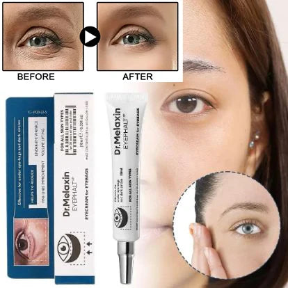 Eyebag Cream 15ml Anti-wrinkle Eye Cream For Dark Circles, Moisturizing Firming Treatment, Lightens Fine Lines Reduces Puffiness