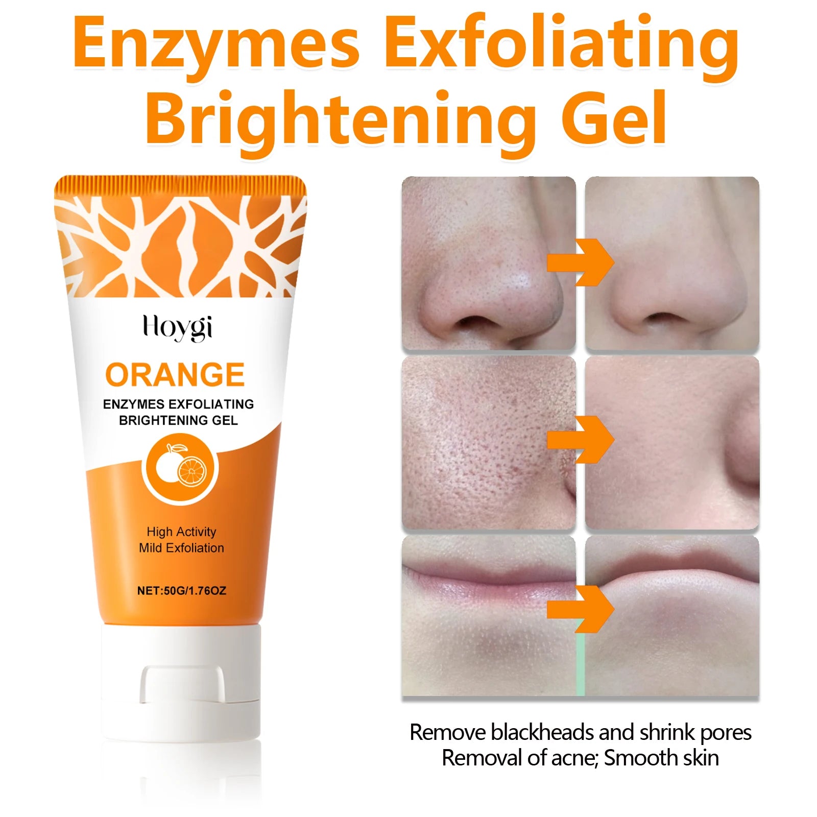 Gentle Exfoliating Blackhead Gel with Niacinamide Pore Minimizing Face Cleanser Oily Dry Sensitive Skin Smooth Bright Skin 50g