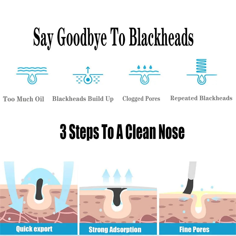 Blackhead Remover Liquid 400ml Deep Cleansing Pore Minimizer with Fruit Acid, Oil Control Toner for T-Zone & Blackhead Treatment