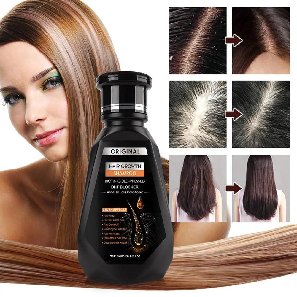 1/2/3Pcs Hair Growth Shampoo, Ginger Shampoo Deep Cleaning Nourish Scalp Deep Cleaning Nourish Scalp Enhance Hair Elasticity