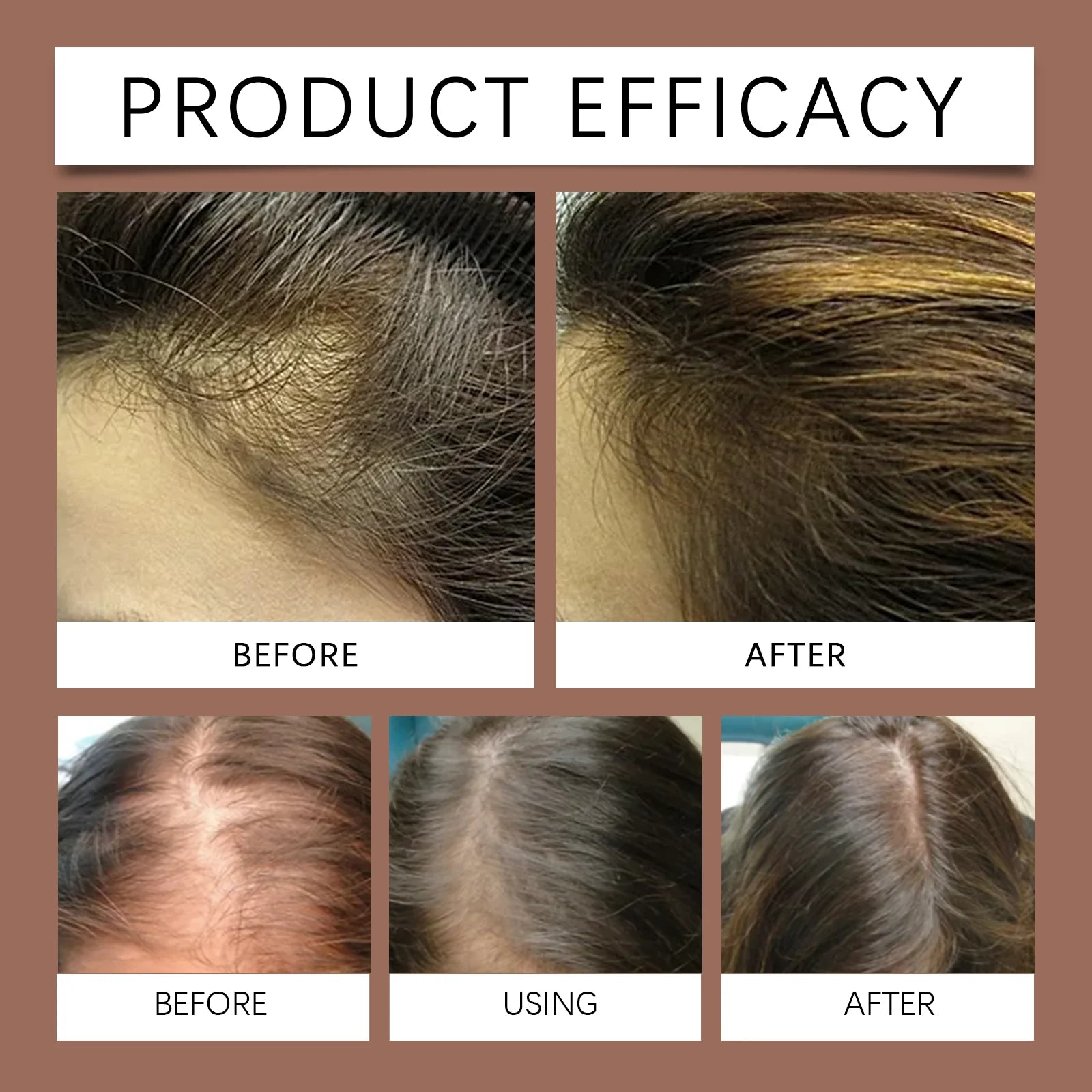 Biotin Caffeine Hair Serum Spray Deep Hydrating Nourishment Strengthen Hair Roots Reduce Hair Loss Smoothing Shiny Hair Care