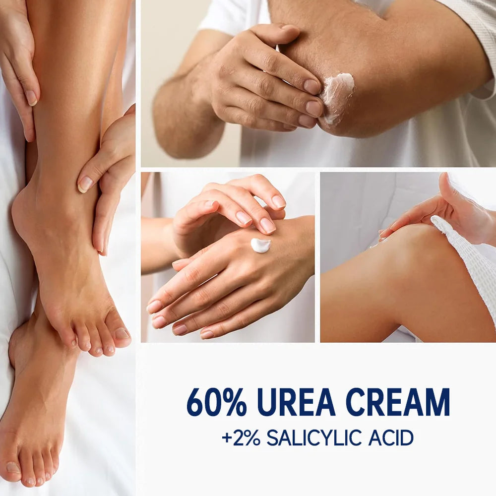 SEYHZE 60% Urea Foot Cream with 2% Salicylic Acid, moisturizing cream suitable for cracked heels and dry hands, soft light beige