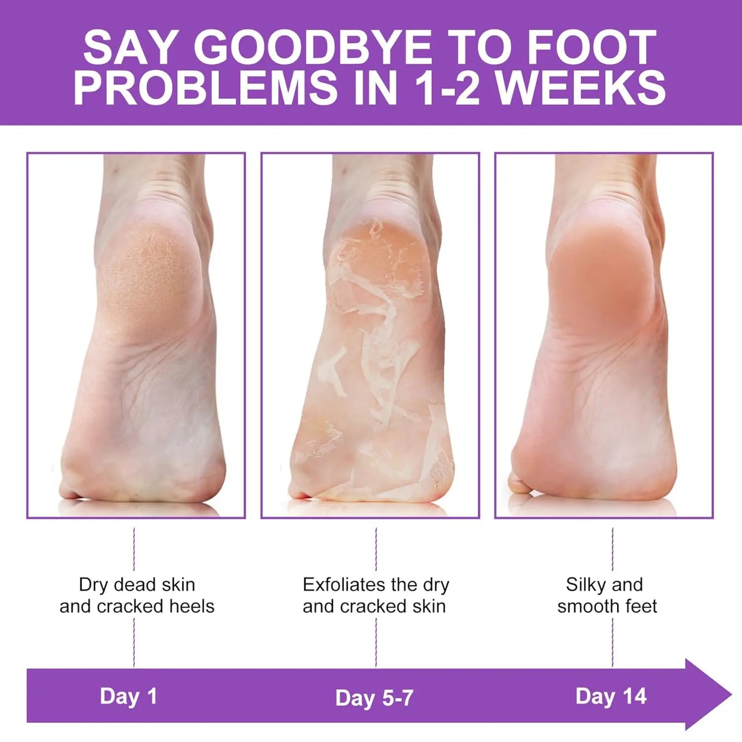 2 Pack Foot Peel Mask Exfoliator Peel Off Calluses Dead Skin Callus Remover Baby Soft Smooth Touch Feet Men Women