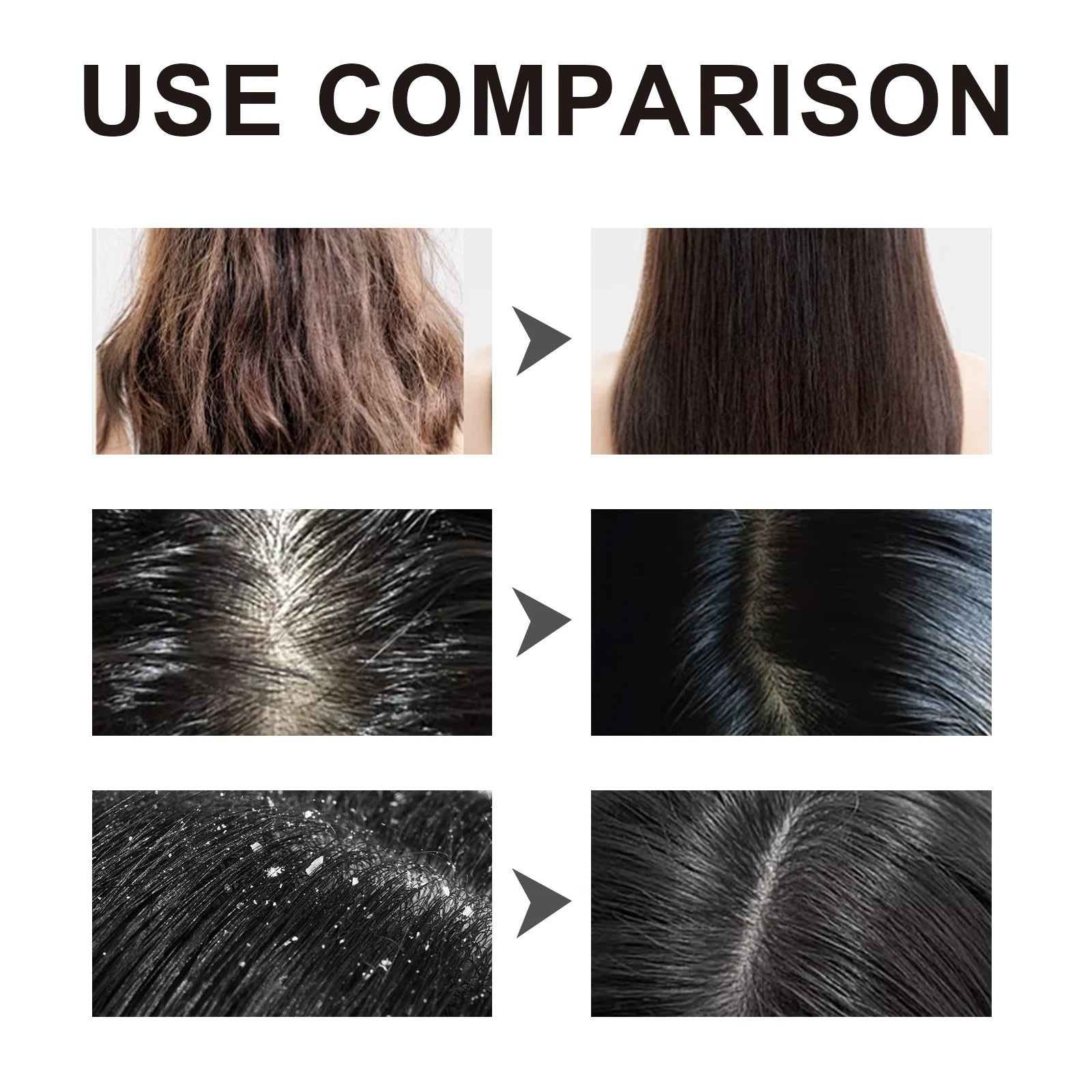 Ginseng Oil Shampoo and Conditioner Hair Strengthens Anti Loss Restore Damaged Cleansing Dandruff Control Hair Growth Shampoo