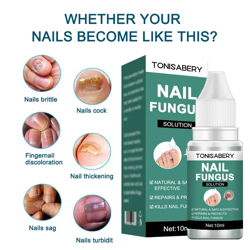 Nail Fungus Treatment Serum Foot Repair Liquid Toe Nails Fungal Removal Gel Anti Infection Paronychia Onychomycosis Cream 10ml