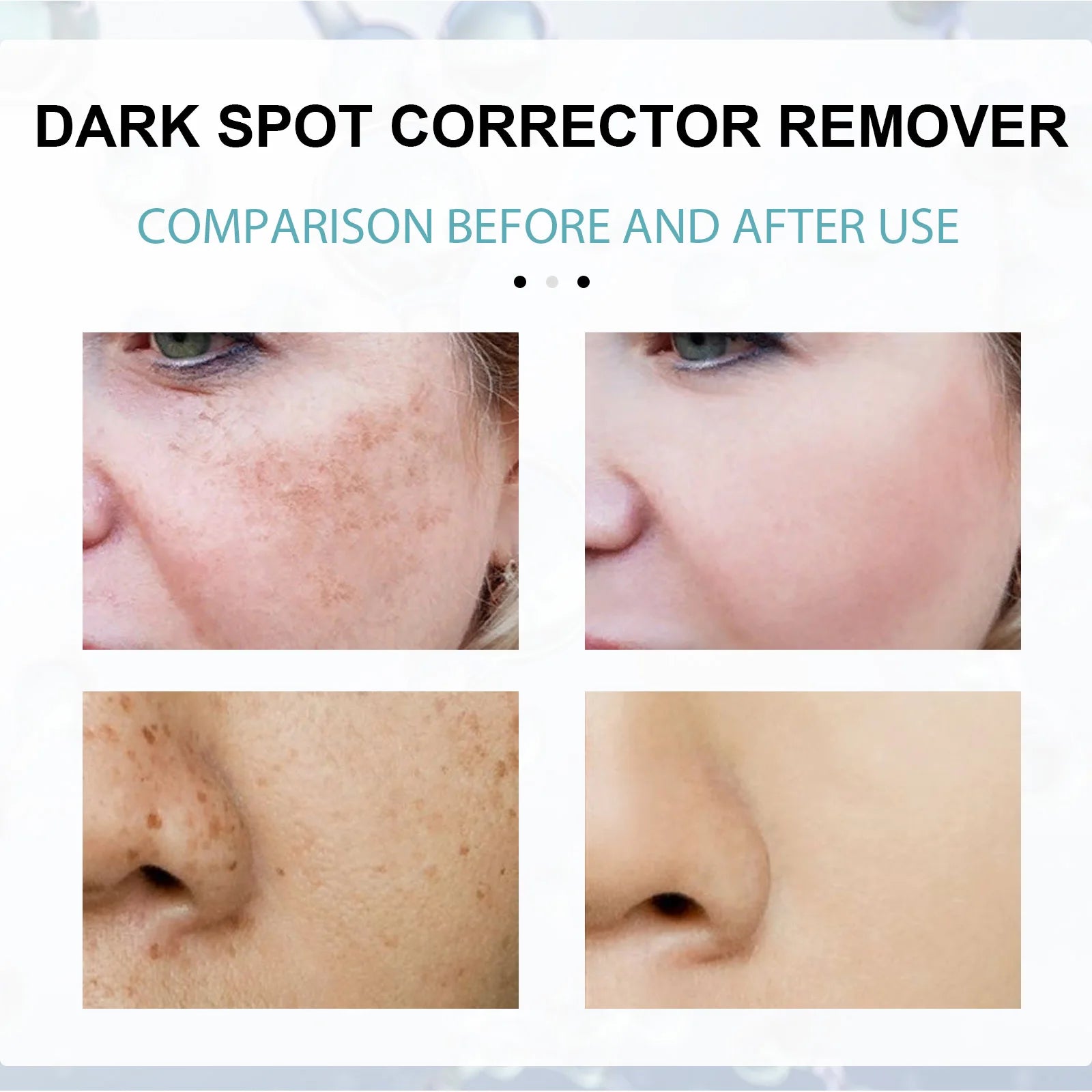 Retinol Whitening And Spot Removing Cream Softens Fine Lines & Wrinkles Repairs Skin Barriers Moisturizing And Brightening Face