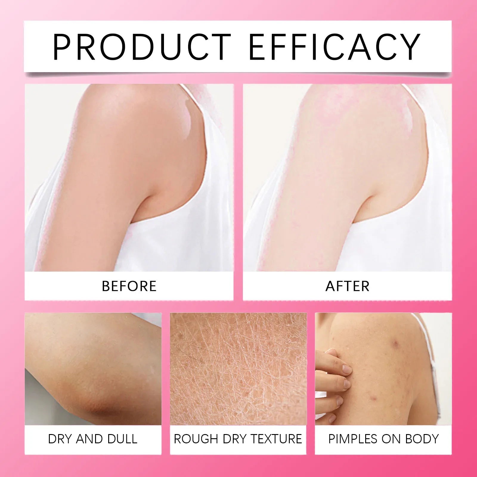 Whitening Cream Private Parts Underarm Bleaching Serum Whiten Butt Knee Brighten Inner Thigh Intimate Parts Dark Remove Melanin