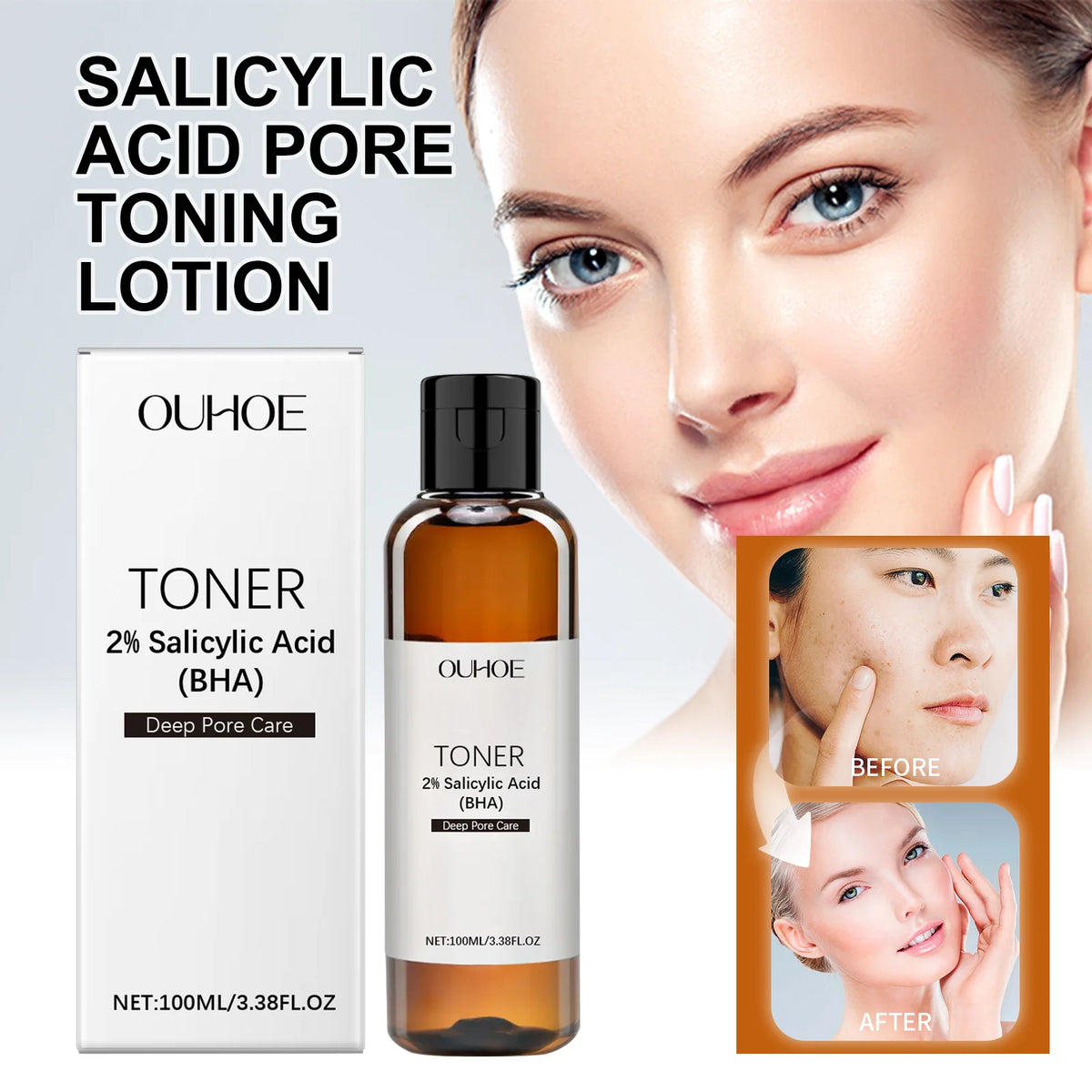 Salicylic Acid Pore Toning Lotion for Oily Clear Skin Exfoliates Gently Unclogs Pores Hydrates Without Drying 100ml Non Drying