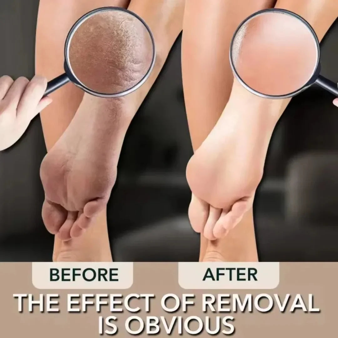 Nano Glass Foot File Double-sided Exfoliating Foot Grinder Hard Dead Skin Callus Remover Foot Scrubber Pedicure Feet Care Tools