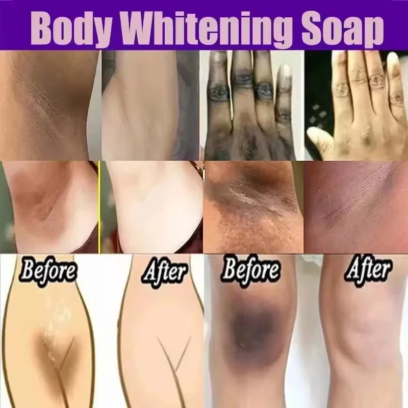 Whitening Cream For Dark Skin Underarm Bleaching Armpit Lightening And Intimate Area Woman Moisturizer Korean Skin Care Products