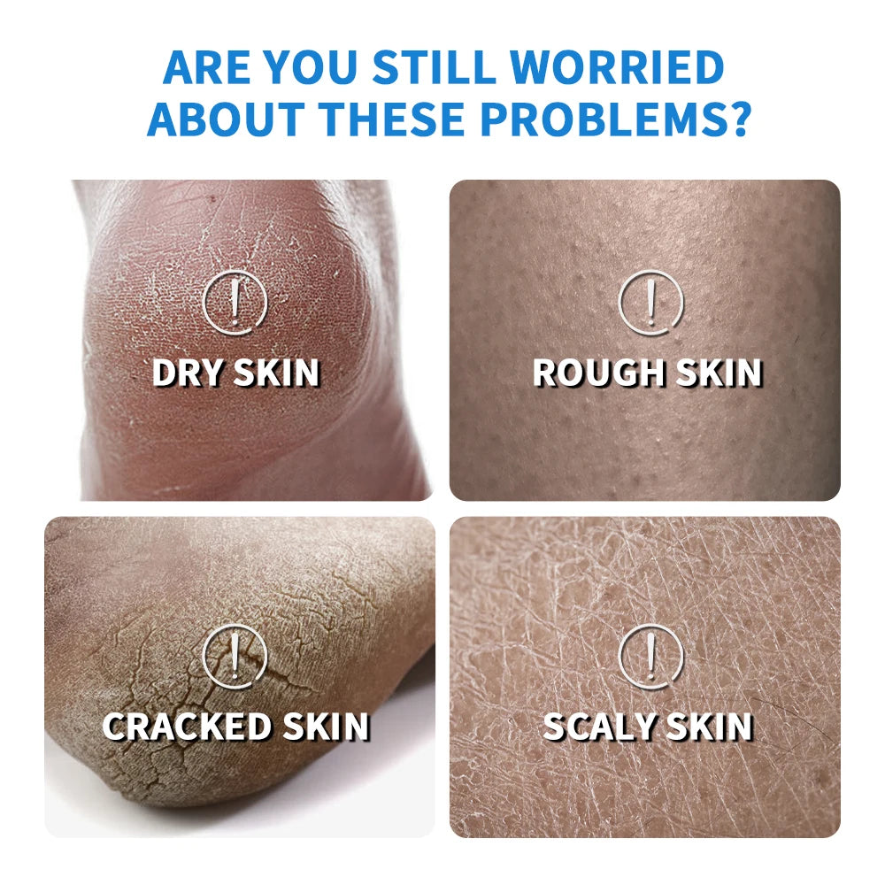 New 42% Urea Cream + 2% Salicylic acid Foot and hand Moisturizer, deep moisturizer and Nourishing moisturizer