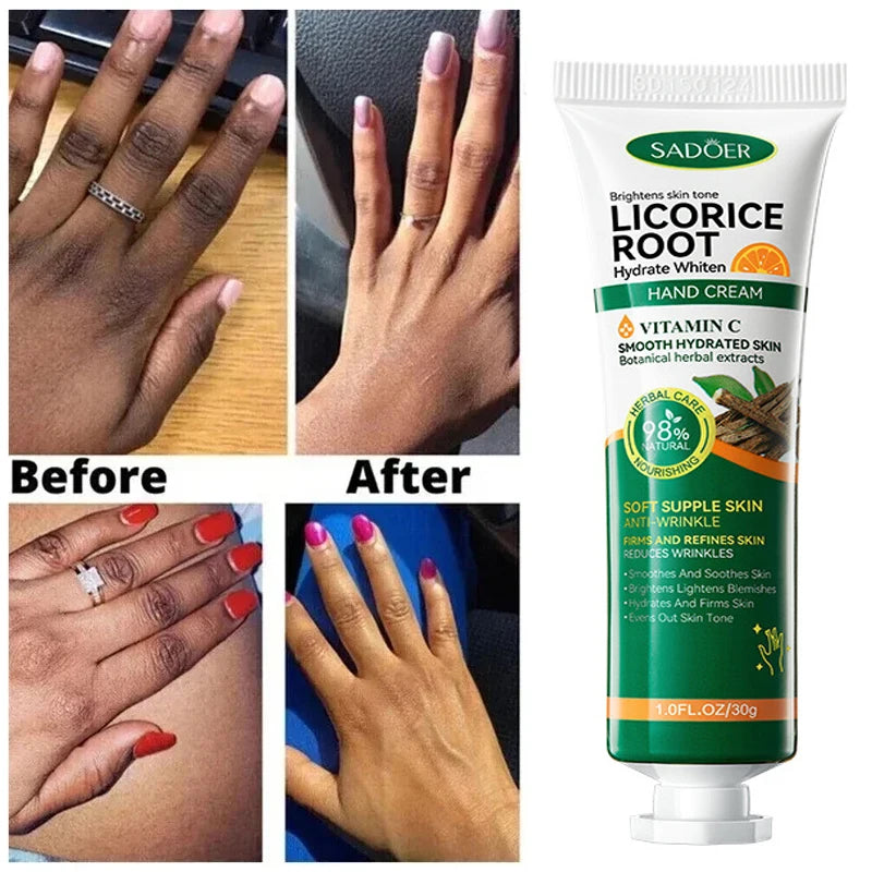 Fast Brighten Dark Knuckles Cream Whiting Hand Cream Lighten Melanin Stains Corrector Hand Anti Crack Soften Moisturize Product