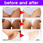 Body Whitening Cream Private Parts Bleach Arm Knees Lip Dark Skin Brighten Melanin Intimate Area Pink Essence Moisturizing Care