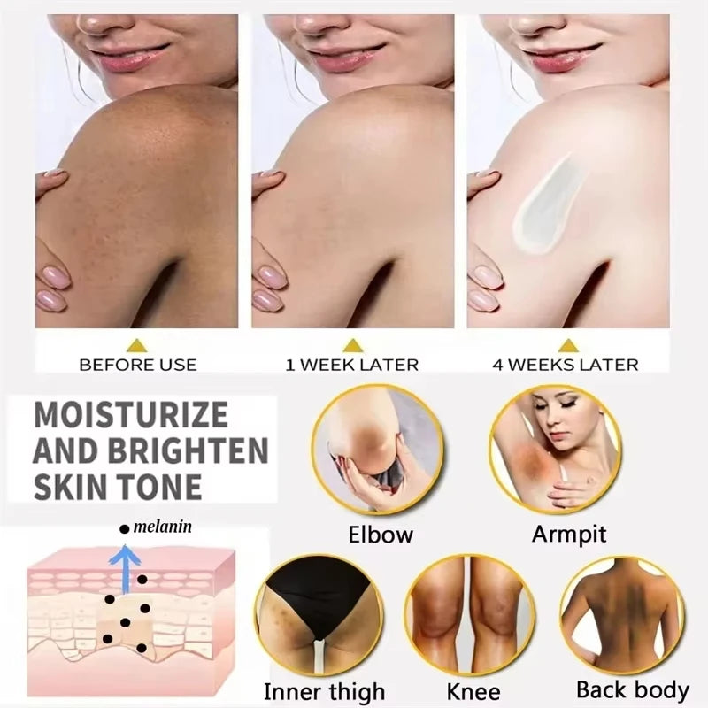 Body whitening cream niacinamide whitening lightening private armpit knee inner thigh whitening nourishing moisturising cream