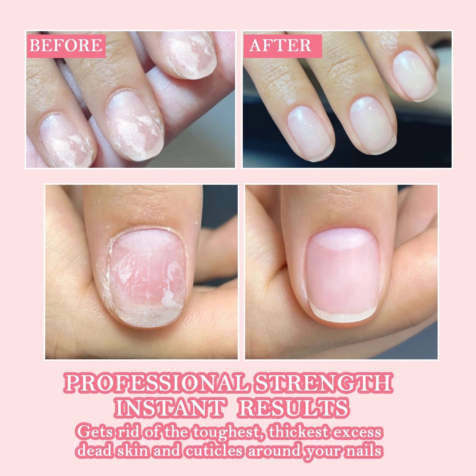 12/20ml Strong Nail Strengthener Calcium Protein Formula Strong Nails Hardener Protect Soft Thin Nails High Quality Repair Suppl