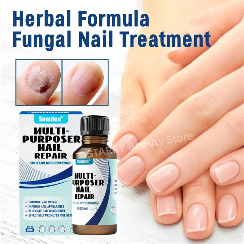Fungal Nail Treatment Serum Foot Nail Fungus Removal Repair Gel Anti Infection Paronychia Onychomycosis Foot Nails Care Essence